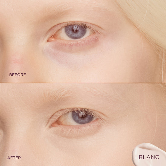Blanc