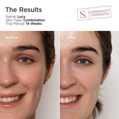 LiquidGlo - Brightening Essence