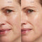 HydraGlo