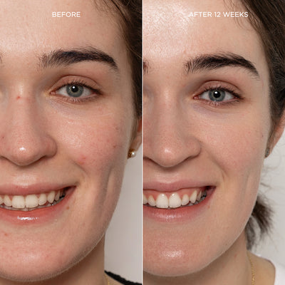 LiquidGlo - Brightening Essence
