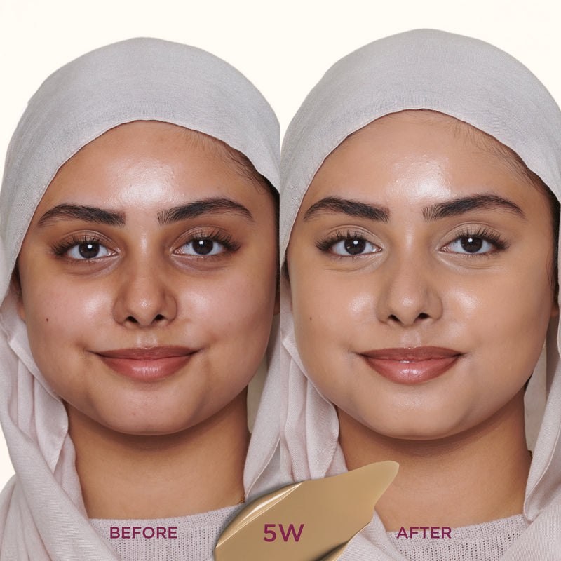 5W